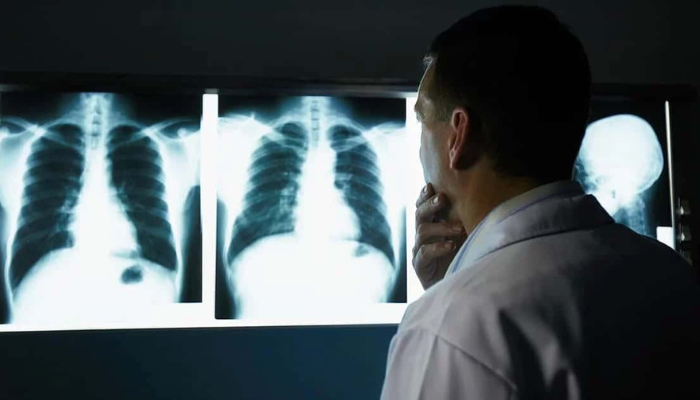 o-que-e-radiografia-como-funciona-o-raio-x O que é Radiografia e como funciona o raio X?