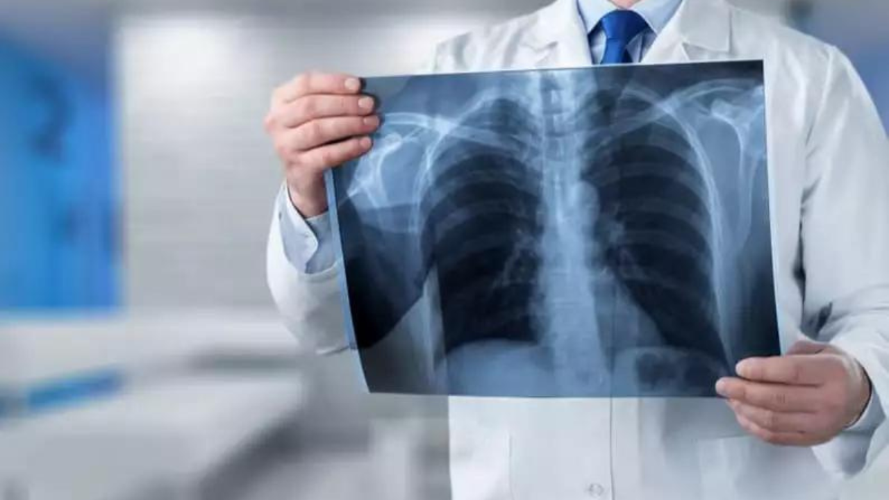 o-que-e-radiografia-e-como-funciona-o-raio-x O que é Radiografia e como funciona o raio X?